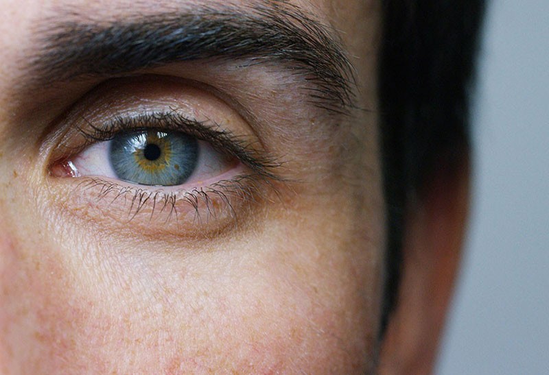 Cornea Cornea