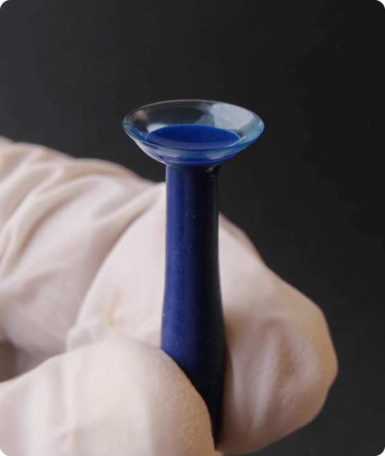 Treating & Managing Keratoconus